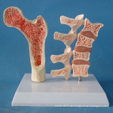 Menschliches Femur und Wirbelsäule Skelett Anatomisches Modell für Demonstration